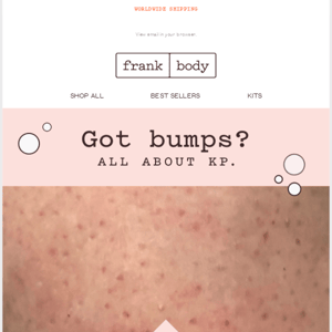 Got bumps on your arms? 🙋‍♀️