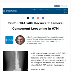 New Case: Painful TKA with Recurrent Femoral Component Loosening in 67M