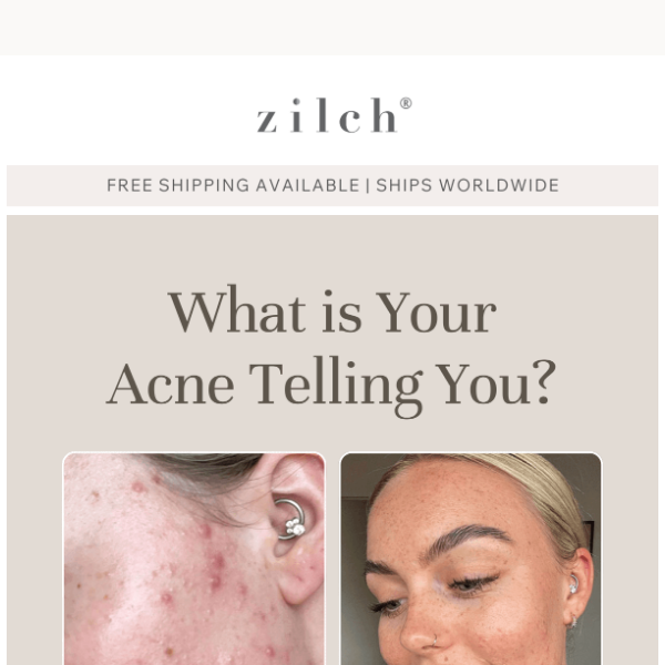 👀 What is Your Acne Telling You?