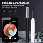Green Lion Visual Earwax Removal Tool - Image 4