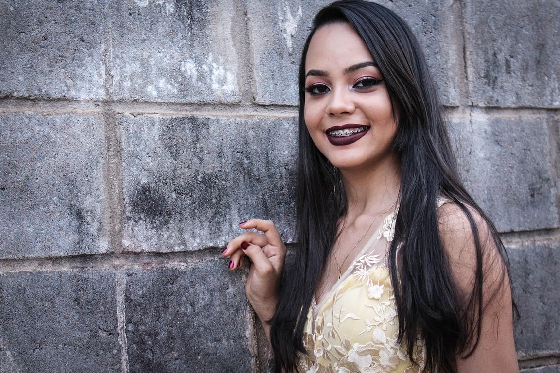 AI braces filter after transformation - influencer photo showing clear AI braces style