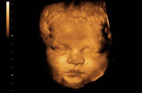 39 hafta gebelik ultrason