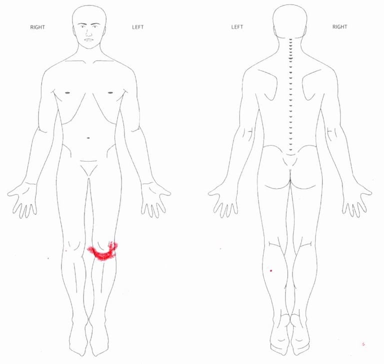 계단에서 무릎 앞쪽이 아프면 모두 슬개건염일까요?