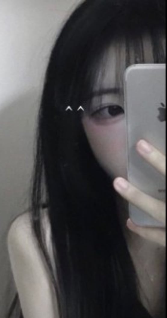 김여우