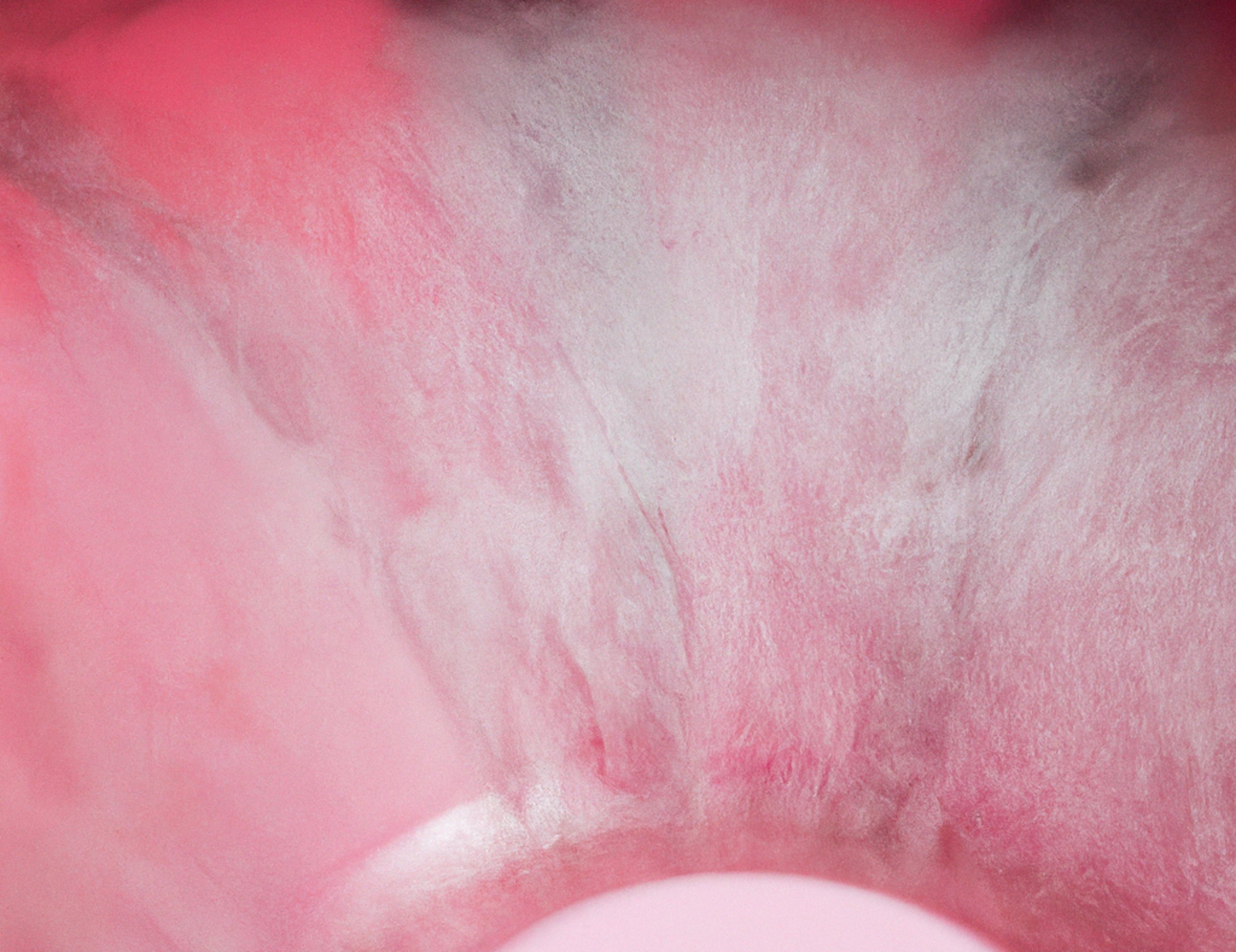 Pink Mold In Humidifier: It's Causes and Remediation