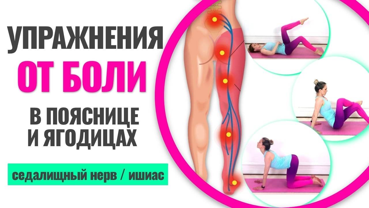 Лучшие упражнения снимающие боль при защемлении седалищного нерва