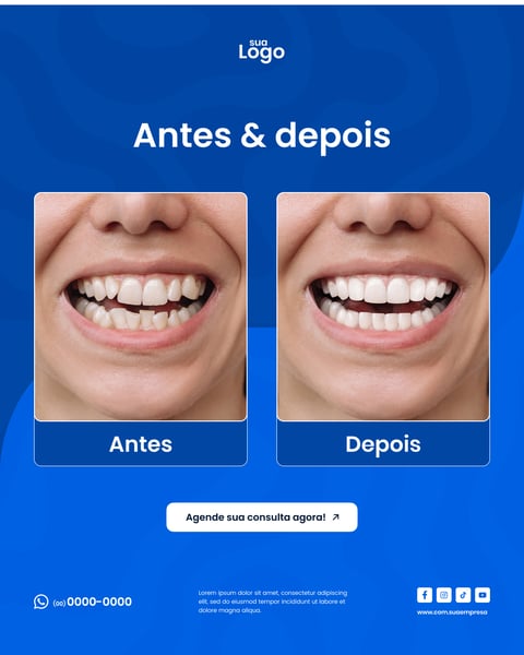 ANTES E DEPOIS Figma Social Media Template