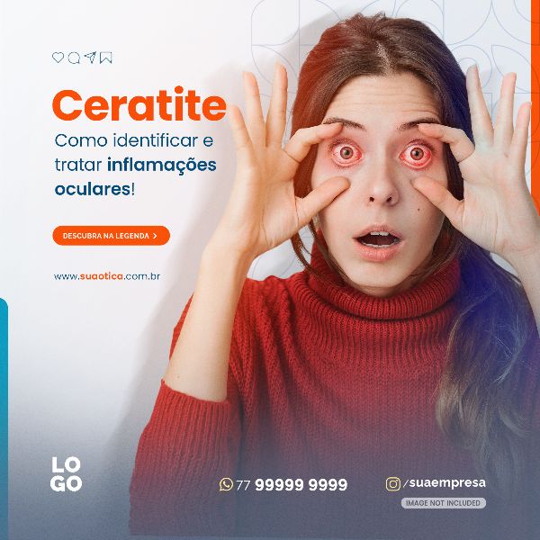 CERATITE - COMO IDENTIFICAR E TRATAR INFLAMAÇÕES OCULARES | SOCIAL MEDIA - ÓTICA