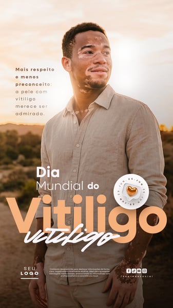 DIA MUNDIAL DO VITILIGO
