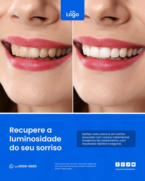 RECUPERE A LUMINOSIDADE DO SEU SORRISO Figma Social Media Template