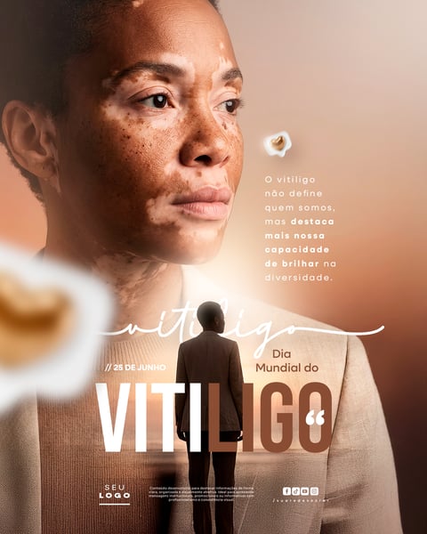 DIA MUNDIAL DO VITILIGO 25 DE JUNHO SOCIAL MEDIA PSD EDITÁVEL 4
