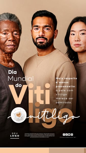 DIA MUNDIAL DO VITILIGO 25 DE JUNHO STORY SOCIAL MEDIA PSD EDITÁVEL 2