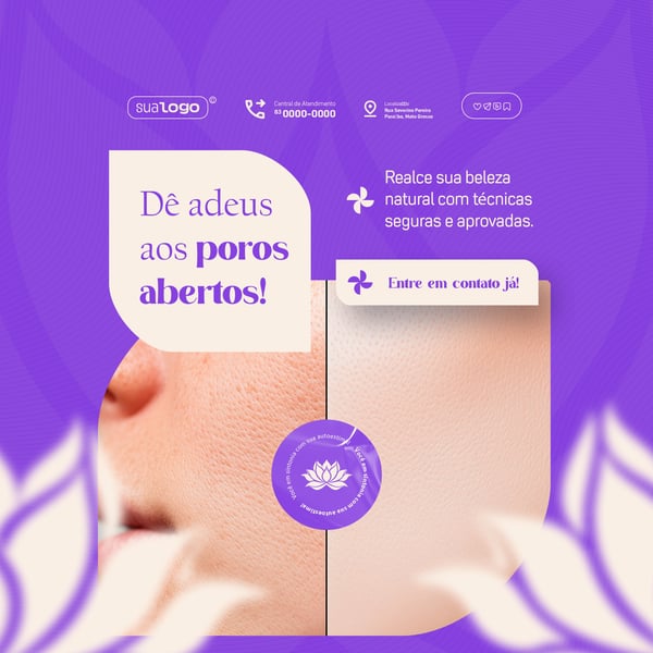 ESTÉTICA CLÍNICA DE BELEZA FEED SOCIAL MEDIA PSD EDITÁVEL