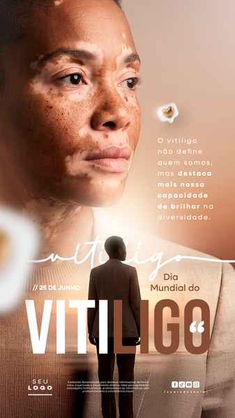 DIA MUNDIAL DO VITILIGO