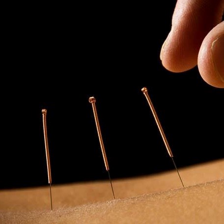 Imagem de perfil do usuário Espaço Vida Bela - Acupuntura