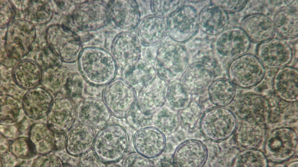 Eimeria Oycysts