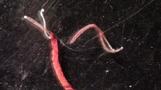 Gapeworm in Chickens: Diagnosis, Treatment, Prevention
