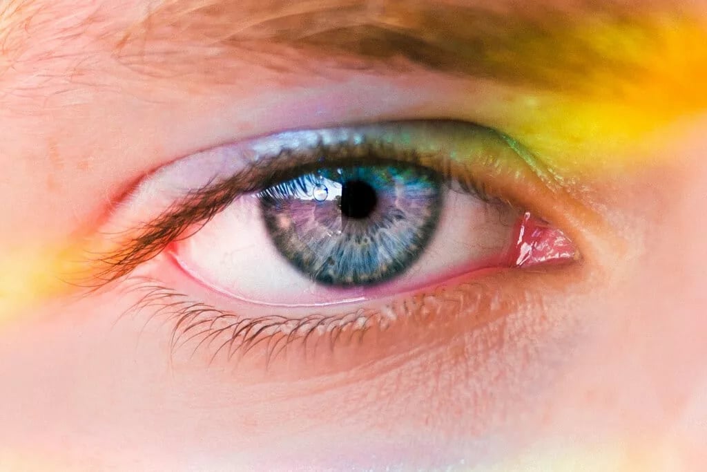 Quick ways to fix red puffy eyes