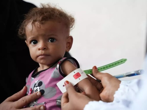 DEGDEG: Caano Budada Ilmaha Ayaa Looga Baahan Yahay Yemen