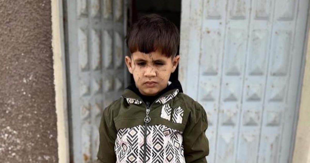 د غزې سترګو درملنې بحران: زرګونه خلک د نابینایۍ له خطر سره مخ دي