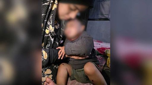 TRT World - Возмущение в связи с пытками палестинского малыша: усиливаются требования призвать Израиль к ответу