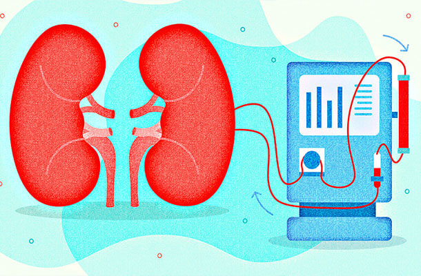 Hemodiyaliz nedir?
