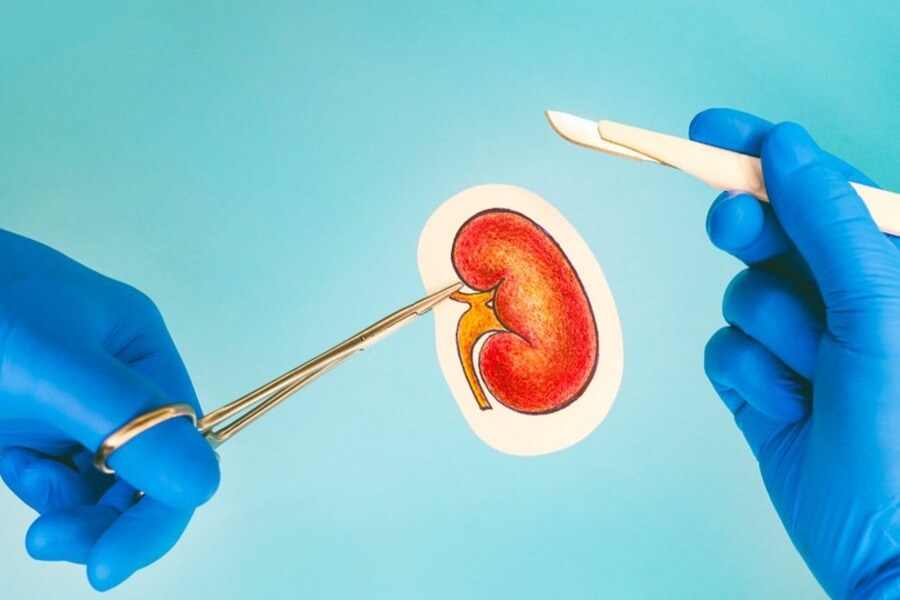 Böbrek Nakli Nedir ve Kimler İçin Uygun Bir Seçenektir?