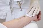 Laser Tattoo Removal Clinic - Prime Rosanna Location Low Overheads & High Margins