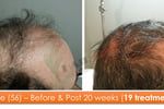 Exciting Business Opportunity in the Hair Loss Treatment Industry - Sydney, NSW