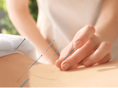 Turnkey Acupuncture Clinic for Sale in Bondi Junction, NSW image