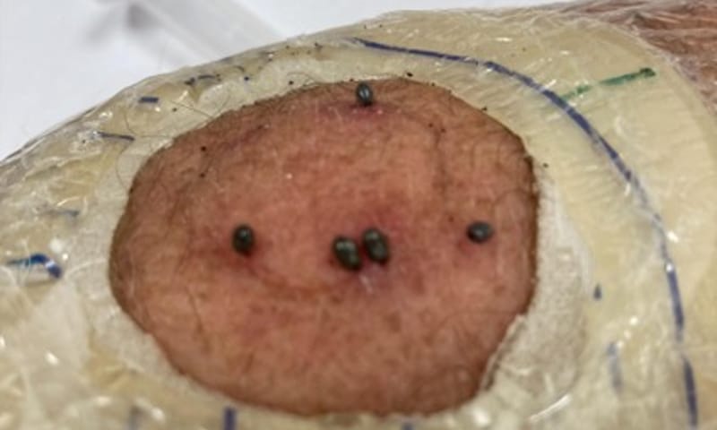 Een participant van het onderzoek laat zich bijten door teken