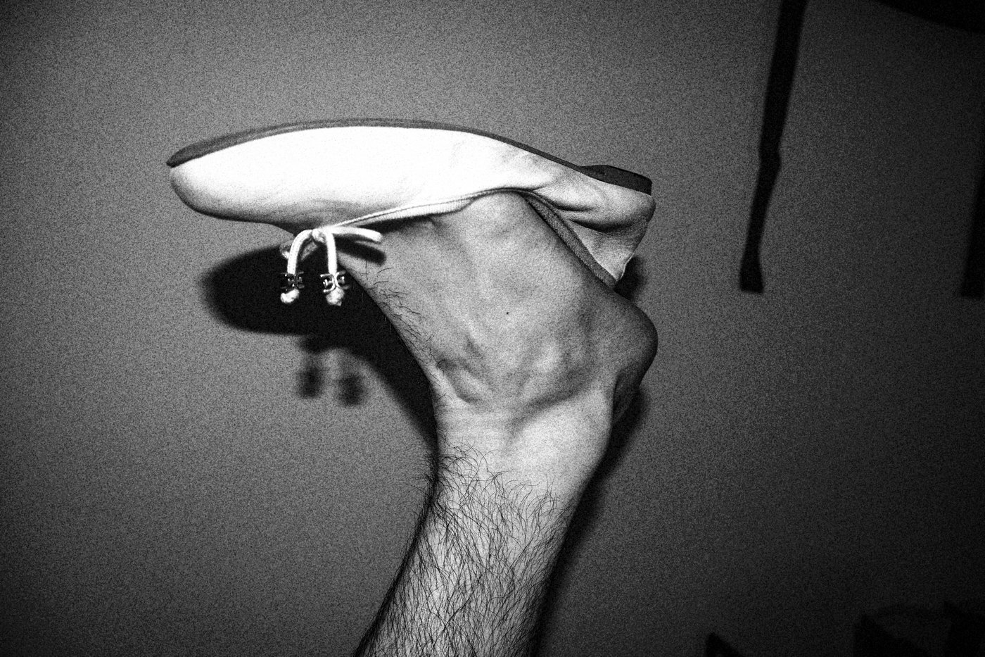 Foot in Ballet that is too small