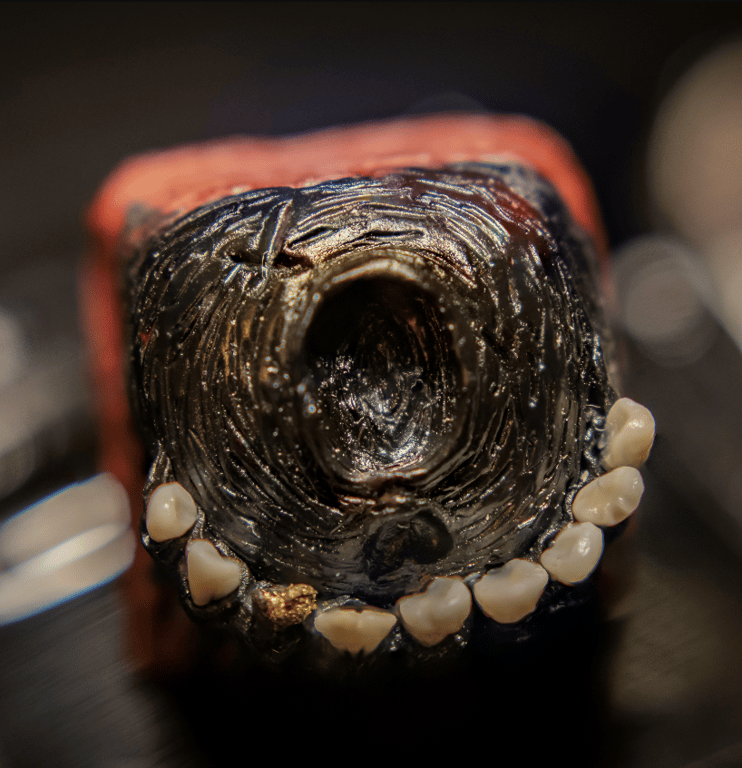 Gold Tooth