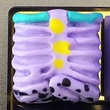 Purple Potato