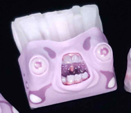 Glans Pink