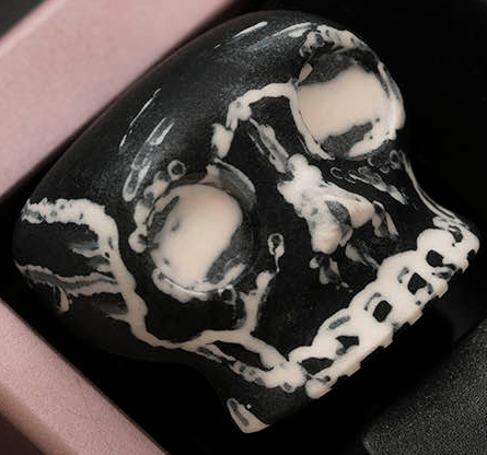 X-ray