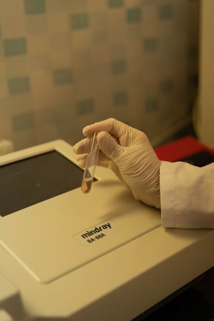 handheld CRISPR diagnostic device lab technician point-of-care