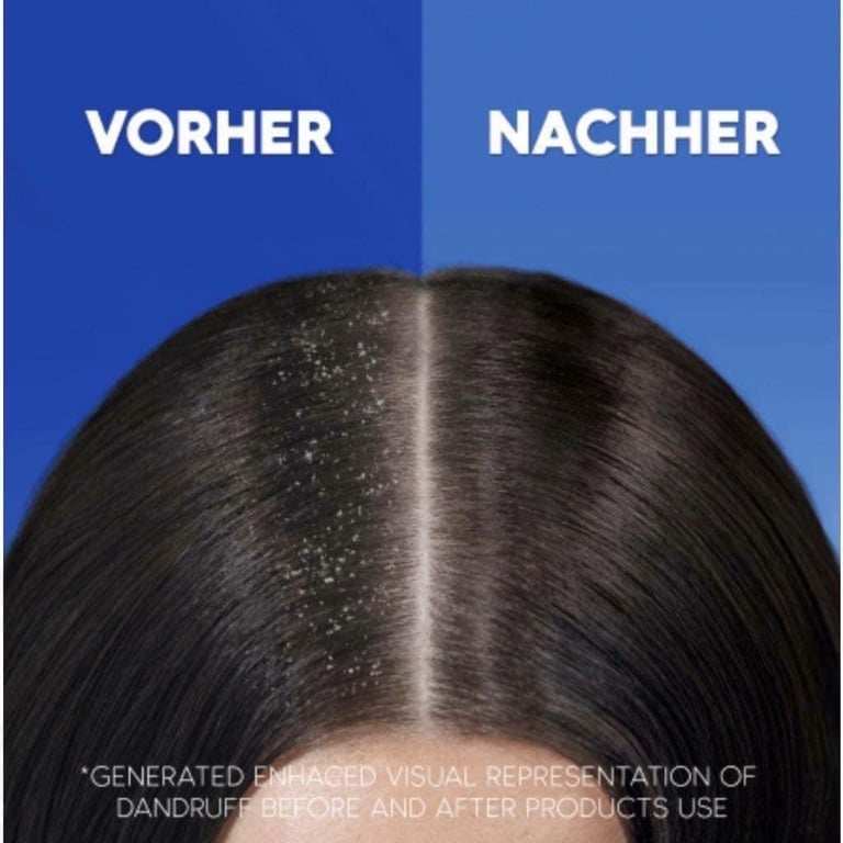 Dầu gội Head & Shoulders 7in1 Multi Action của Pháp