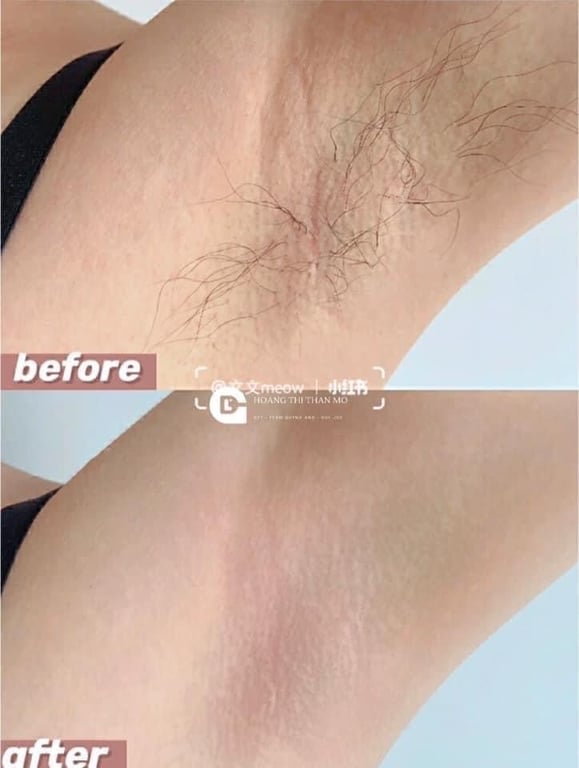 Wax TẨY LÔNG VEET