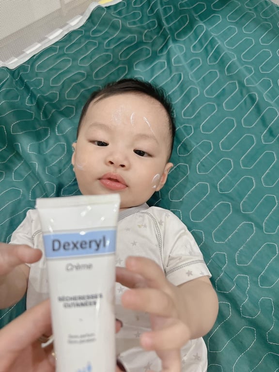 𝐊𝐄𝐌 𝐍𝐄̉ 𝐃𝐄𝐗𝐄𝐑𝐘𝐋 𝐏𝐇𝐀́𝐏