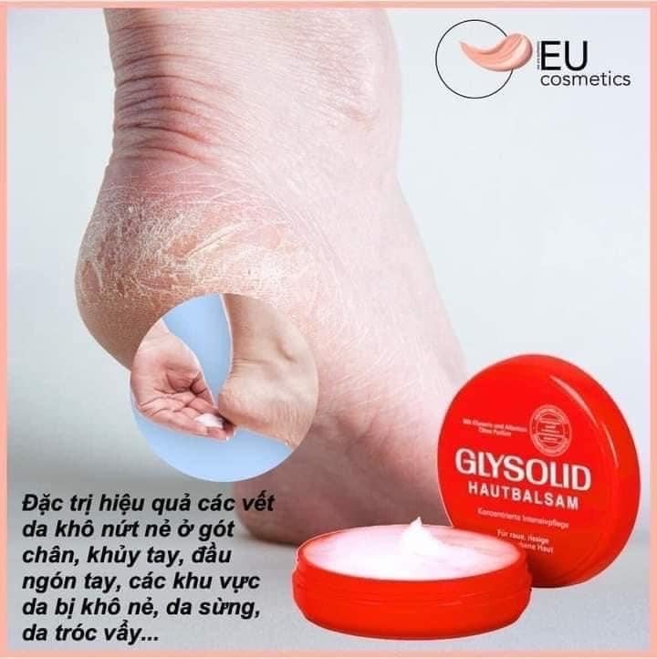 KEM DƯỠNG Glysolid Đức trị nẻ, Á sừng, nứt gót chân ...