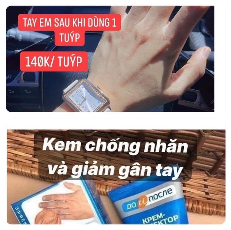 Kem dưỡng tay Kpem