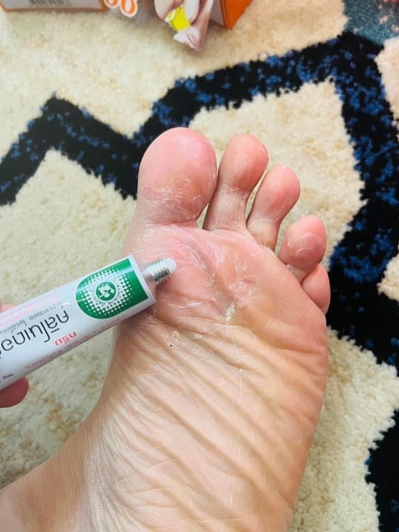 KEM BÔI DA TRỊ VẢY NẾN, NGỨA, VIÊM DA CLINODERM THÁI LAN Tuýp 15gram