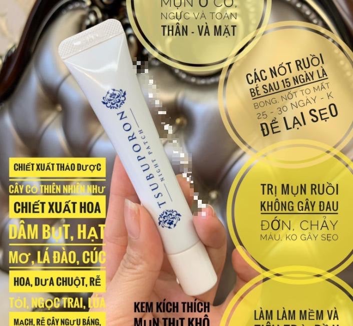 𝐊𝐞𝐦 𝐓𝐫𝐢̣ 𝐍𝐨̂́𝐭 𝐑𝐮𝐨̂̀𝐢 𝐓𝐬𝐮𝐛𝐮𝐩𝐨𝐫𝐨𝐧 𝐍𝐢𝐠𝐡𝐭 𝐏𝐚𝐜𝐤 - 𝐍𝐡𝐚̣̂𝐭 𝐁𝐚̉𝐧