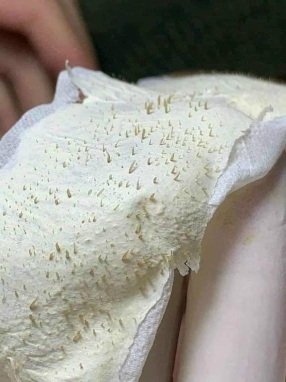 Kem lột mụn Thái Lan