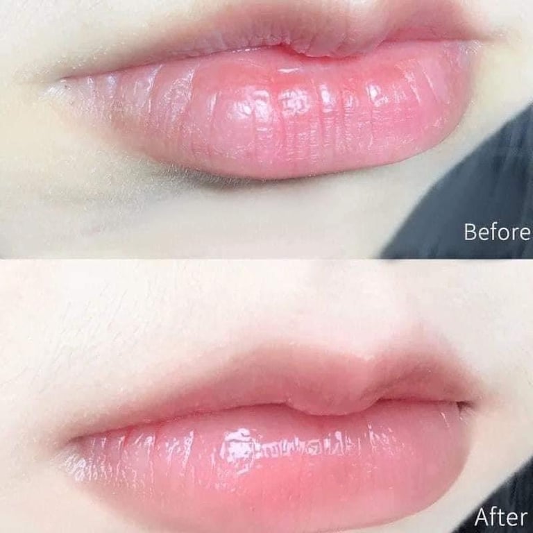 𝐒𝐀́𝐏 𝐃𝐔̛𝐎̛̃𝐍𝐆 𝐀̂̉𝐌 𝐕𝐀𝐒𝐄𝐋𝐈𝐍𝐄 49G