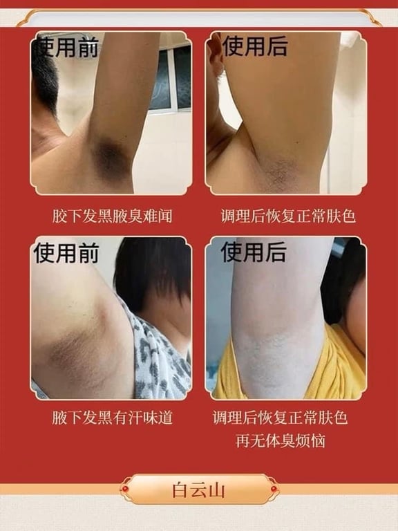 Tinh chất đặc trị hôi nách đông y Trung Quốc