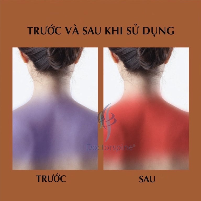 ĐAI CHƯỜM NÓNG NGẢI CỨU GIÚP GIẢM ĐAU CỔ – VAI – GÁY