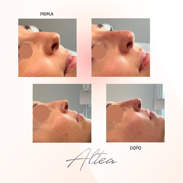 Voyager (misquotextx) Farcaster social identity (Fname handle) PFP