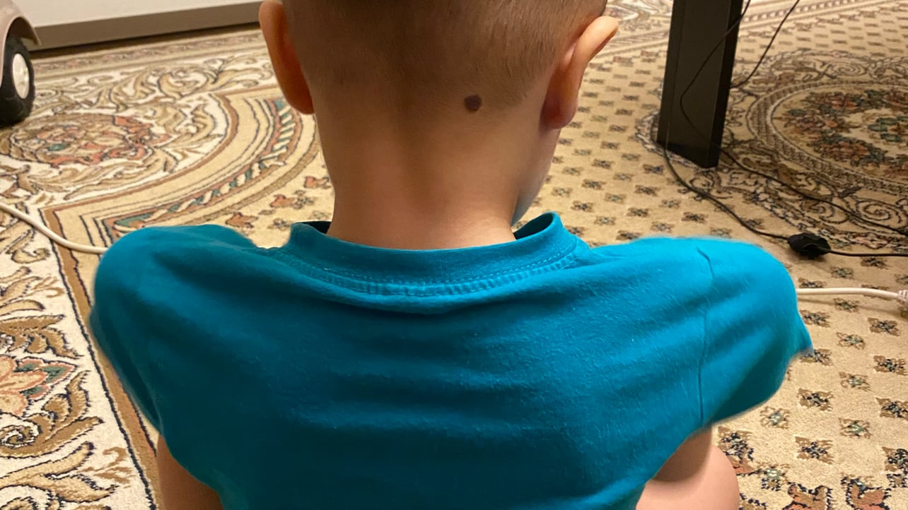 duplesis.linea.eth Linea Name Service (.linea.eth domains) based on ENS PFP